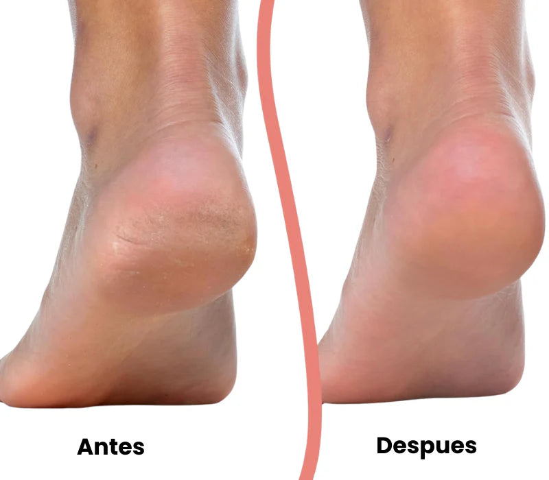 Velura Beauty | Renueva tus pies al instante